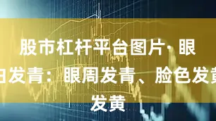 股市杠杆平台图片· 眼白发青：眼周发青、脸色发黄